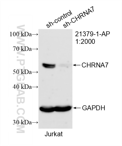 Western Blot (WB) analysis of Jurkat cells using CHRNA7 Polyclonal antibody (21379-1-AP)