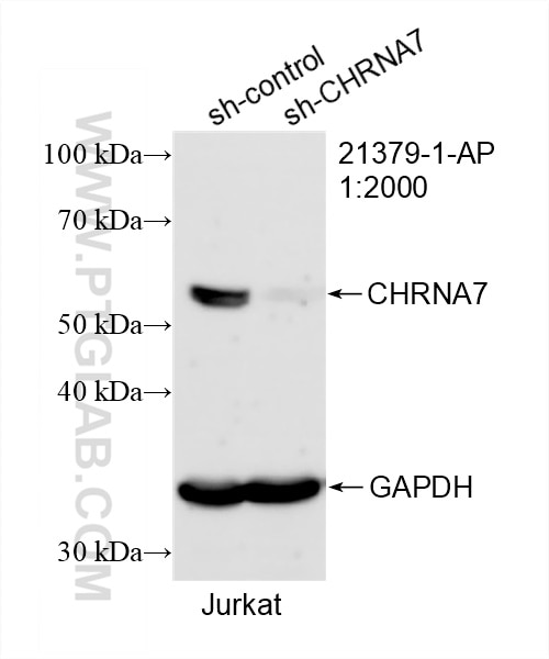 WB analysis of Jurkat using 21379-1-AP