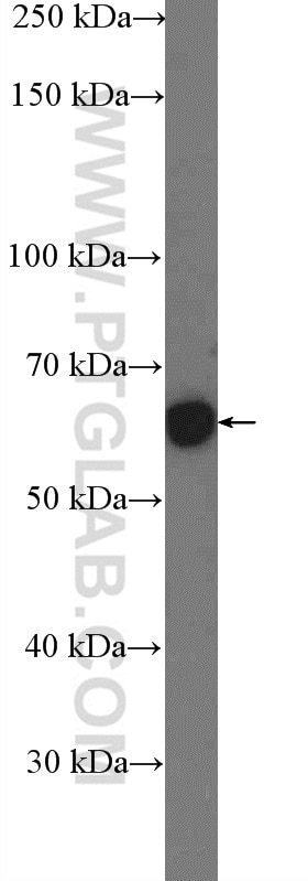 Western Blot (WB) analysis of mouse skeletal muscle tissue using CHRNA7 Polyclonal antibody (21379-1-AP)