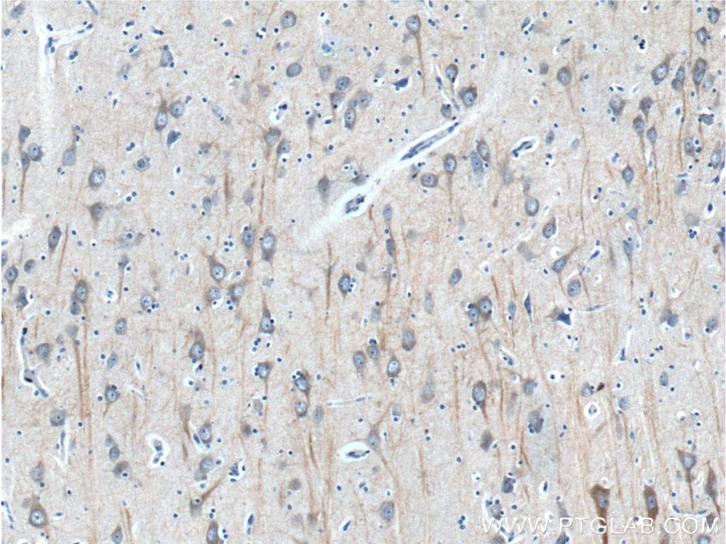 Immunohistochemistry (IHC) staining of human brain tissue using CHRNA7 Monoclonal antibody (60220-1-Ig)