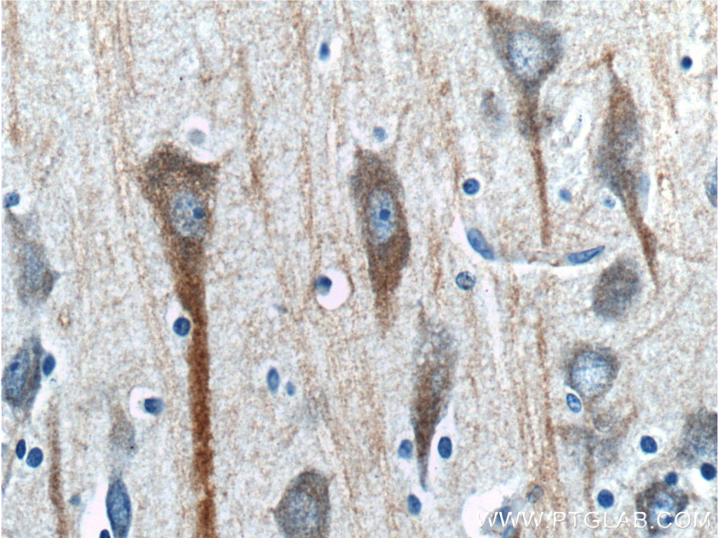 Immunohistochemistry (IHC) staining of human brain tissue using CHRNA7 Monoclonal antibody (60220-1-Ig)