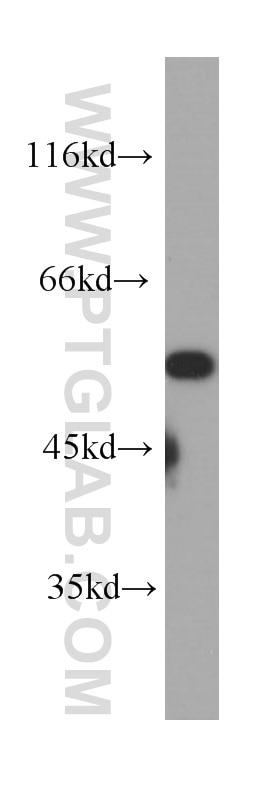 Western Blot (WB) analysis of MCF-7 cells using CHRNA7 Monoclonal antibody (60220-1-Ig)