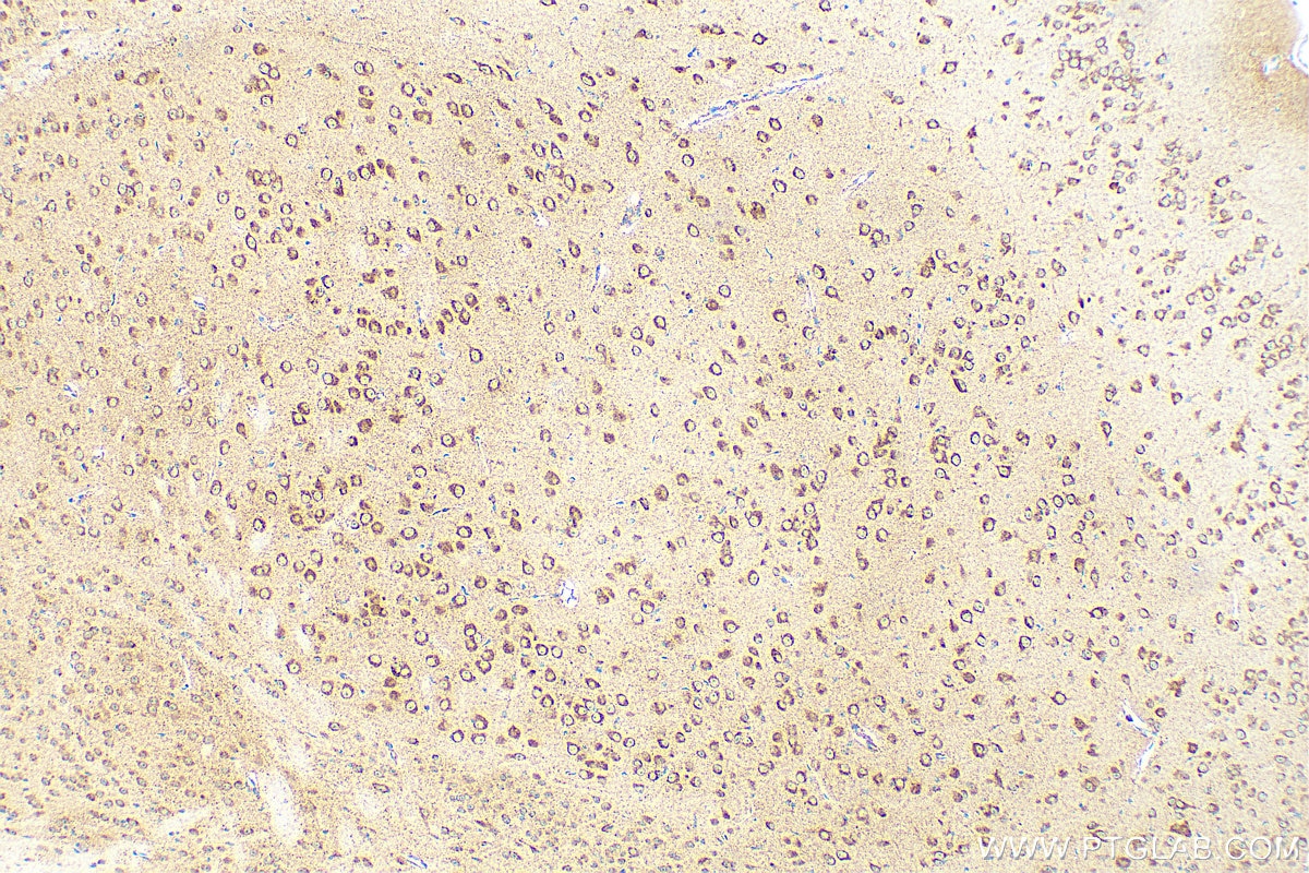 Immunohistochemistry (IHC) staining of mouse brain tissue using CHRNA7 Recombinant antibody (82848-3-RR)