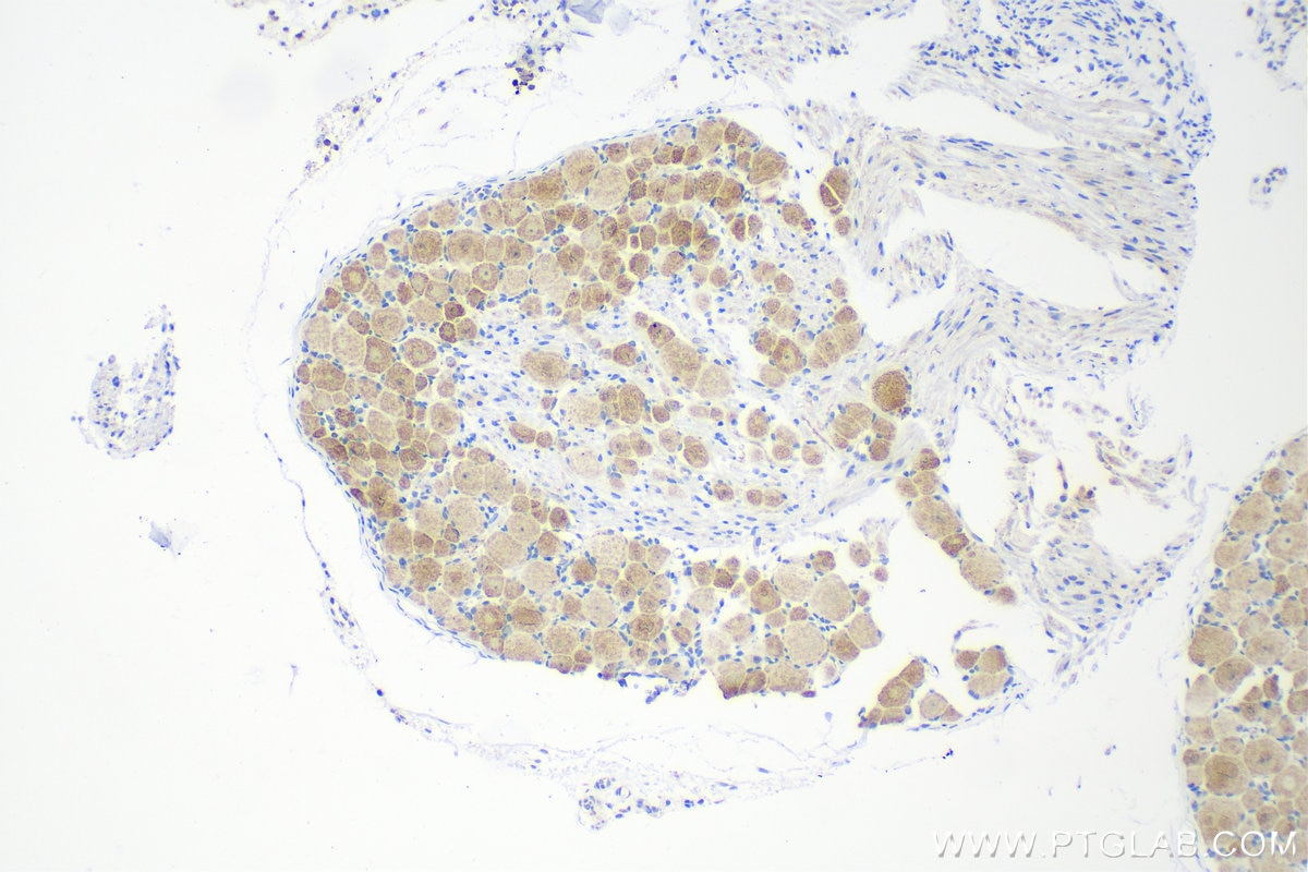 Immunohistochemistry (IHC) staining of rat dorsal root ganglion tissue using CHRNA7 Recombinant antibody (82848-3-RR)