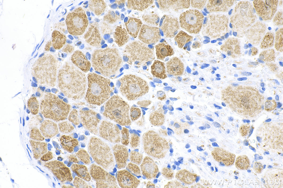 Immunohistochemistry (IHC) staining of rat dorsal root ganglion tissue using CHRNA7 Recombinant antibody (82848-3-RR)