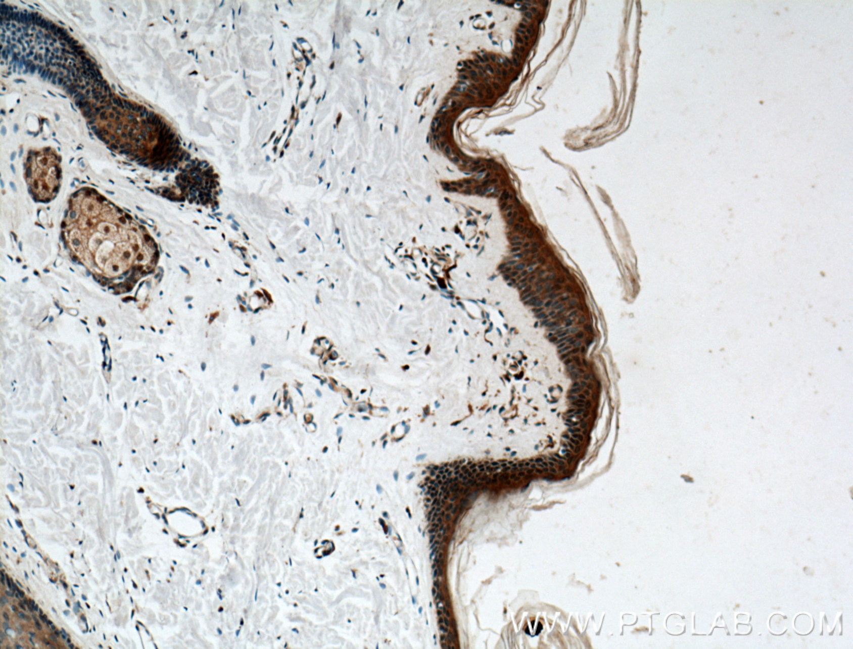 Immunohistochemistry (IHC) staining of human skin tissue using CHRNA9 Polyclonal antibody (26025-1-AP)