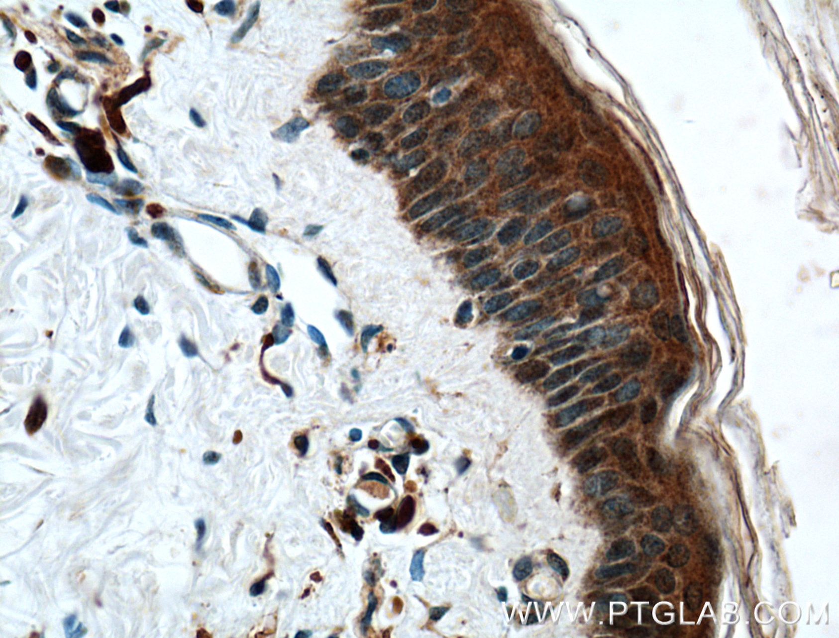 Immunohistochemistry (IHC) staining of human skin tissue using CHRNA9 Polyclonal antibody (26025-1-AP)