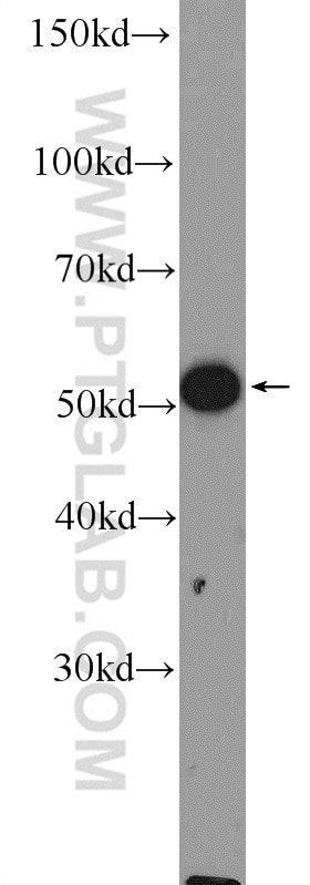 Western Blot (WB) analysis of mouse skin tissue using CHRNA9 Polyclonal antibody (26025-1-AP)