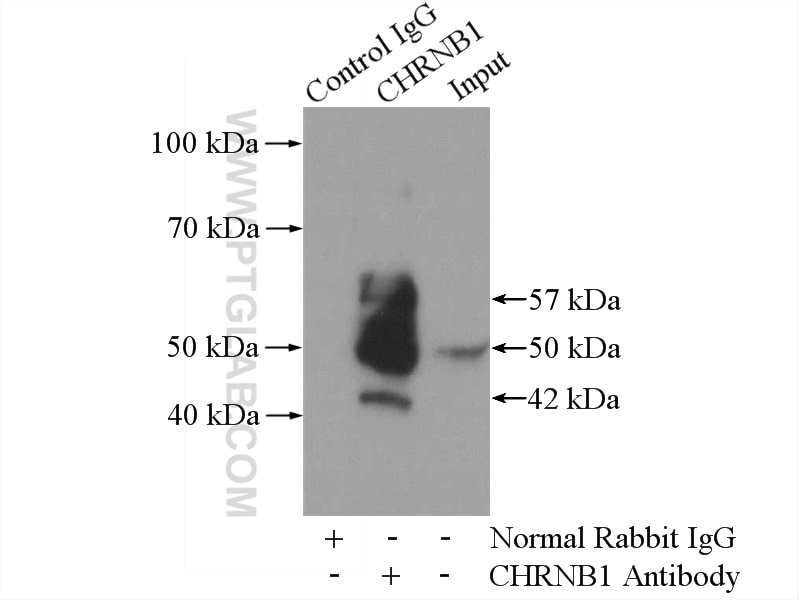 Immunoprecipitation (IP) experiment of mouse liver tissue using CHRNB1 Polyclonal antibody (11553-1-AP)