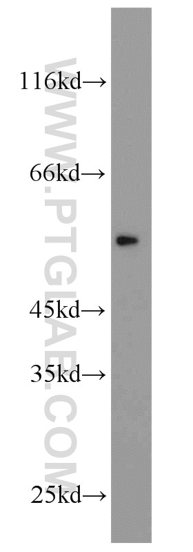 Western Blot (WB) analysis of human liver tissue using CHRNB1 Polyclonal antibody (11553-1-AP)