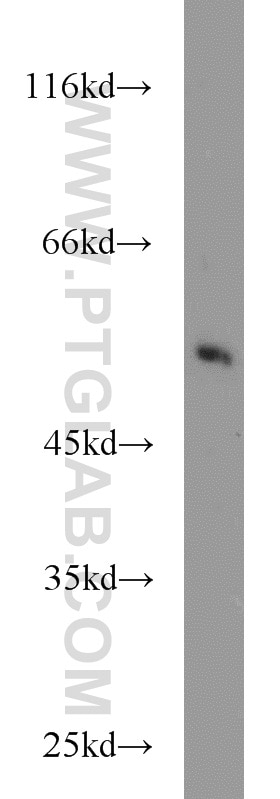 Western Blot (WB) analysis of mouse liver tissue using CHRNB1 Polyclonal antibody (11553-1-AP)