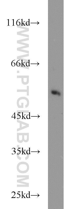 WB analysis of mouse liver using 11553-1-AP