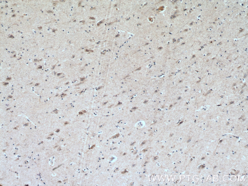 Immunohistochemistry (IHC) staining of human brain tissue using CHRNB2 Polyclonal antibody (17844-1-AP)