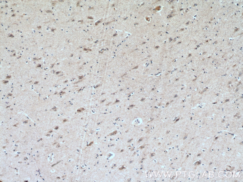 IHC staining of human brain using 17844-1-AP