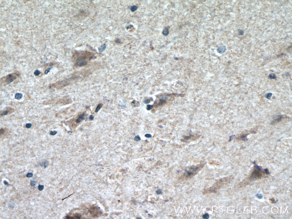 Immunohistochemistry (IHC) staining of human brain tissue using CHRNB2 Polyclonal antibody (17844-1-AP)