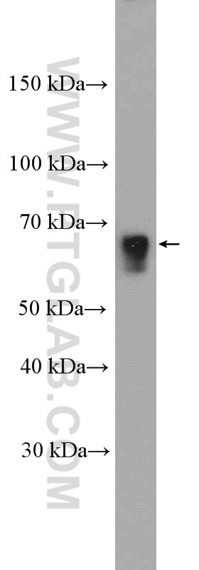 Western Blot (WB) analysis of mouse brain tissue using CHRNB2 Polyclonal antibody (17844-1-AP)