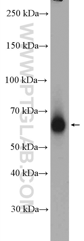 Western Blot (WB) analysis of SH-SY5Y cells using CHRNB2 Polyclonal antibody (17844-1-AP)