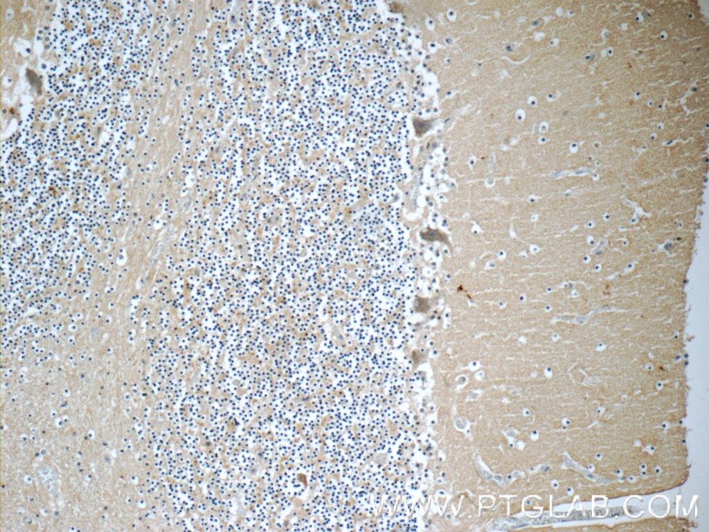 IHC staining of human cerebellum using 18037-1-AP