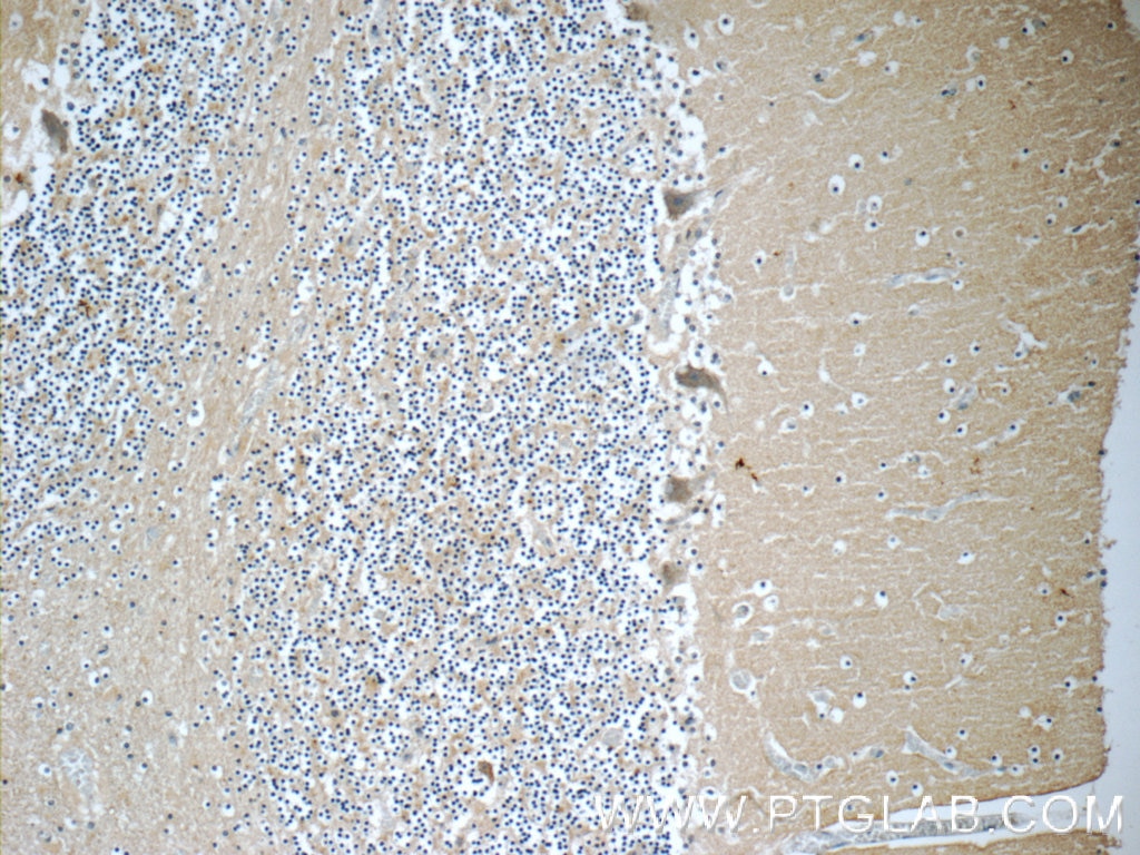 Immunohistochemistry (IHC) staining of human cerebellum tissue using CHRNB3 Polyclonal antibody (18037-1-AP)