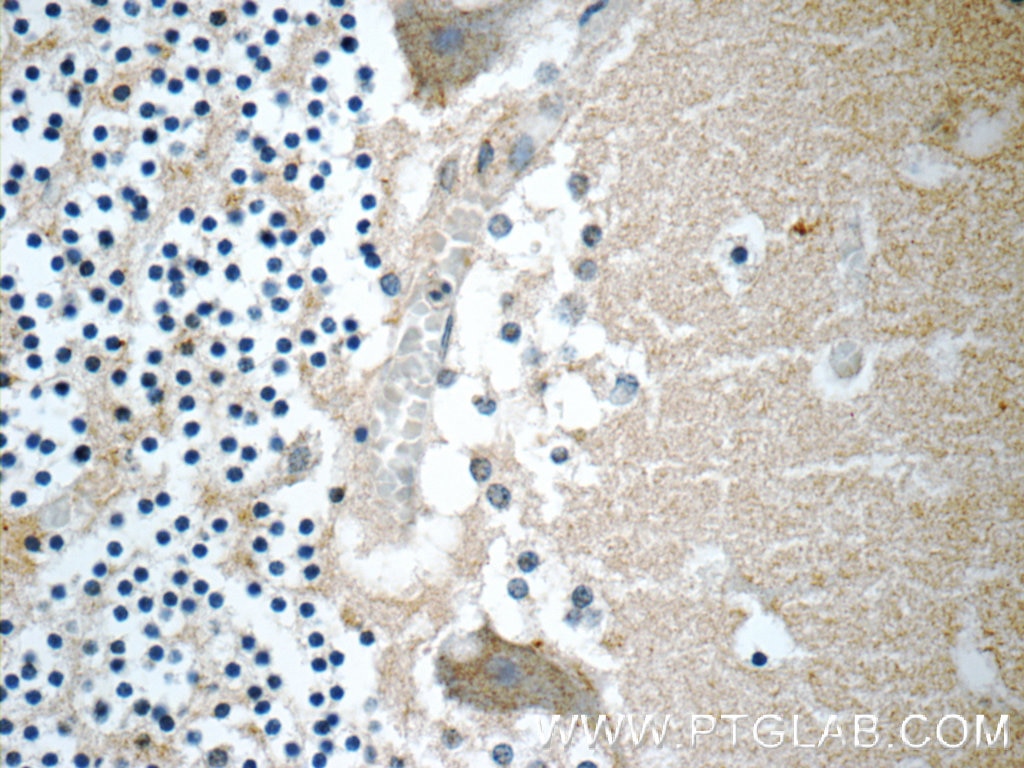 Immunohistochemistry (IHC) staining of human cerebellum tissue using CHRNB3 Polyclonal antibody (18037-1-AP)