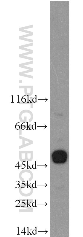 Western Blot (WB) analysis of HeLa cells using CHRNB4 Polyclonal antibody (22192-1-AP)