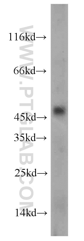 Western Blot (WB) analysis of mouse testis tissue using CHRNB4 Polyclonal antibody (22192-1-AP)