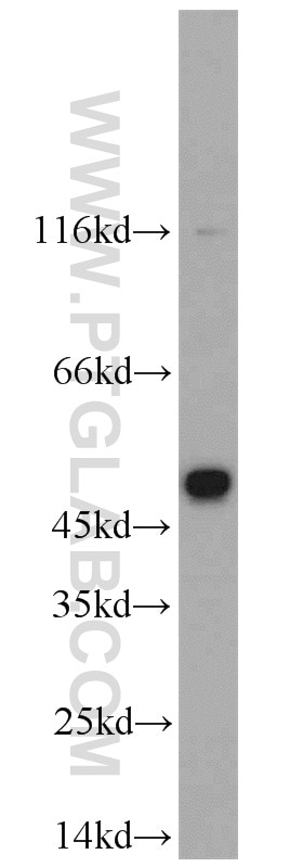 Western Blot (WB) analysis of SH-SY5Y cells using CHRNB4 Polyclonal antibody (22192-1-AP)