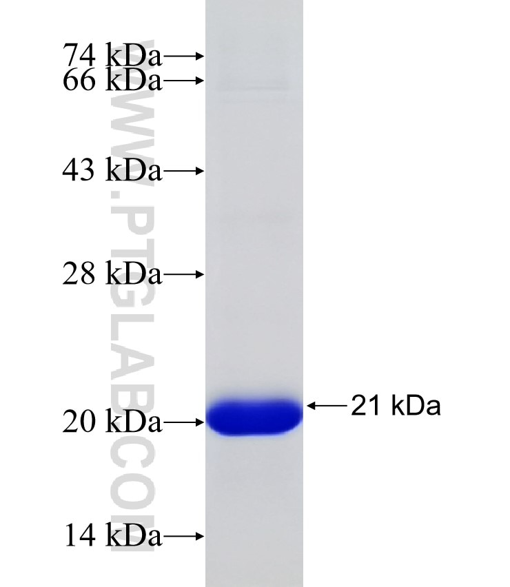 CHRNB4 fusion protein Ag31759 SDS-PAGE CHRNB4 fusion protein Ag31759 SDS-PAGE