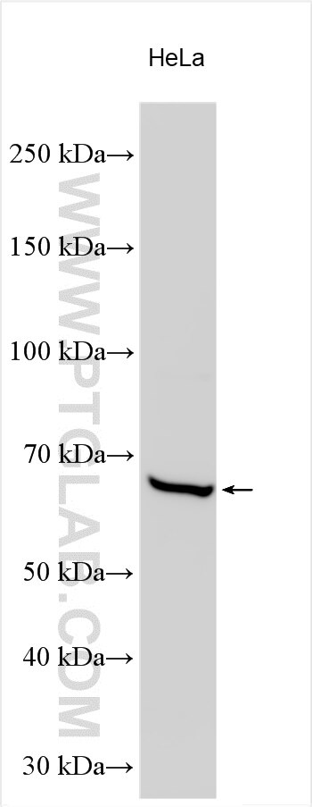 Western Blot (WB) analysis of various lysates using CHRNG Polyclonal antibody (21928-1-AP)