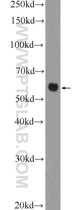 Western Blot (WB) analysis of Jurkat cells using CHST1 Polyclonal antibody (12504-1-AP)