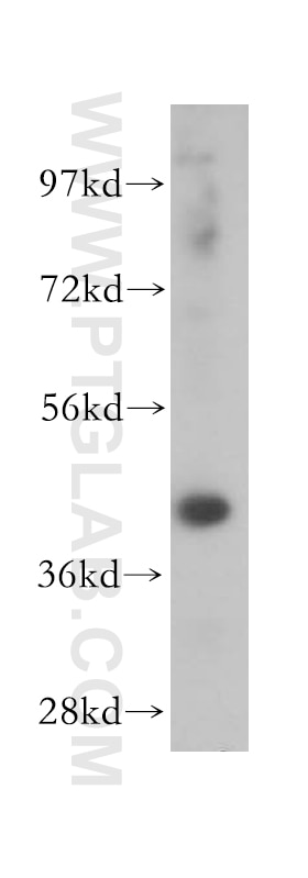 Western Blot (WB) analysis of Jurkat cells using CHST11 Polyclonal antibody (15959-1-AP)