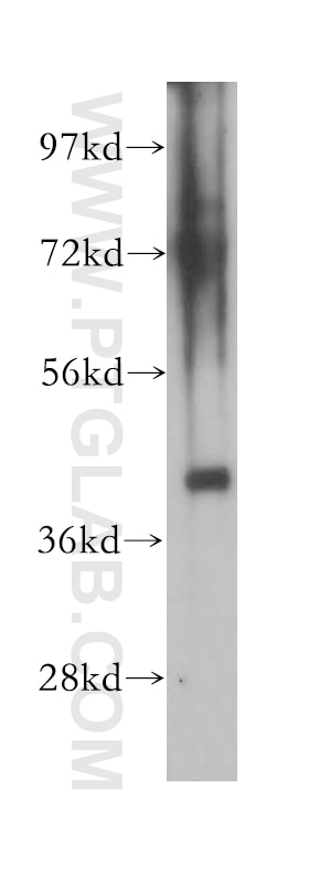 Western Blot (WB) analysis of human placenta tissue using CHST11 Polyclonal antibody (15959-1-AP)