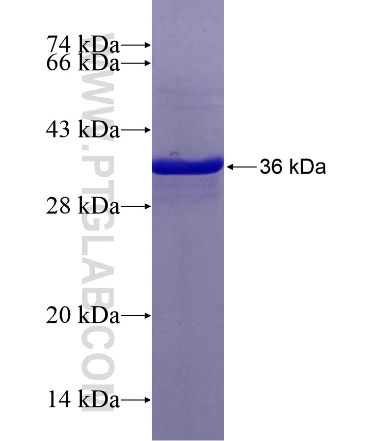 CHST11 fusion protein Ag29352 SDS-PAGE