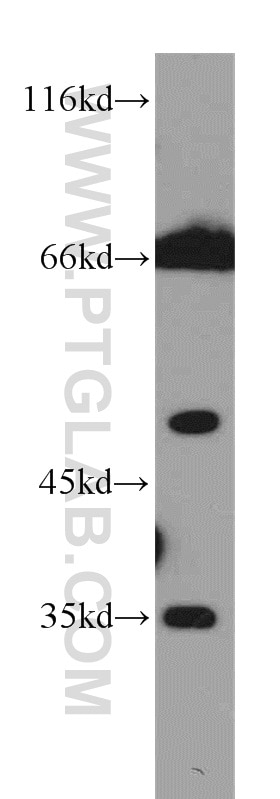 Western Blot (WB) analysis of K-562 cells using CHST12 Polyclonal antibody (15341-1-AP)