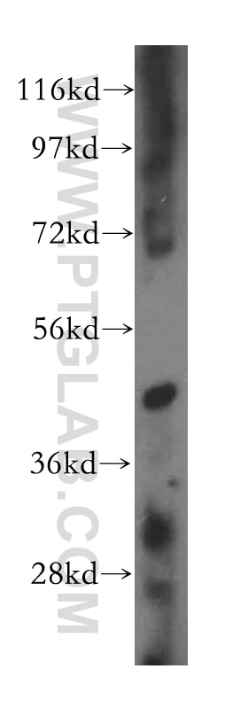 Western Blot (WB) analysis of K-562 cells using CHST12 Polyclonal antibody (15341-1-AP)