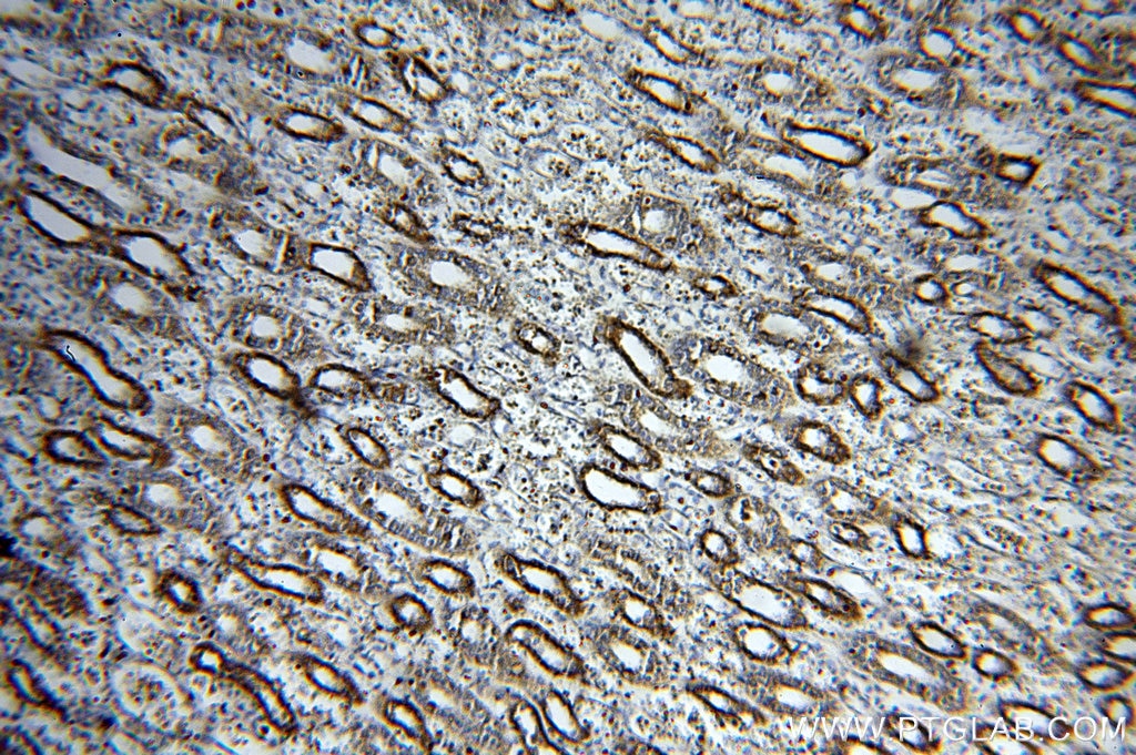 Immunohistochemistry (IHC) staining of human kidney tissue using CHST13-Specific Polyclonal antibody (20141-1-AP)