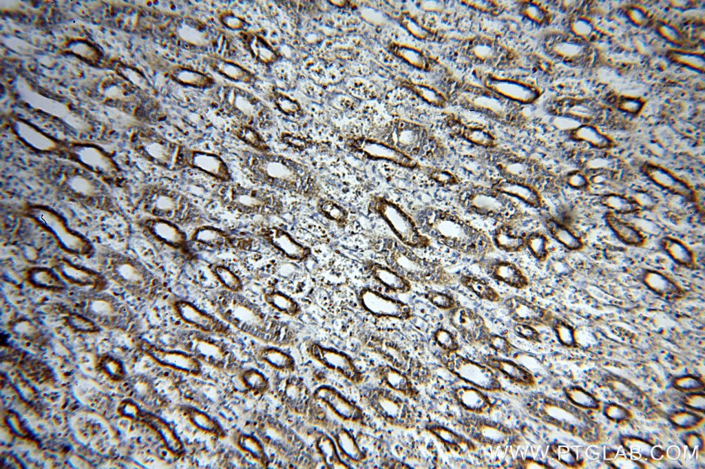 IHC staining of human kidney using 20141-1-AP