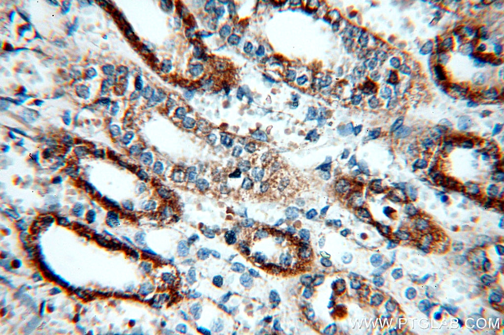 Immunohistochemistry (IHC) staining of human kidney tissue using CHST13-Specific Polyclonal antibody (20141-1-AP)