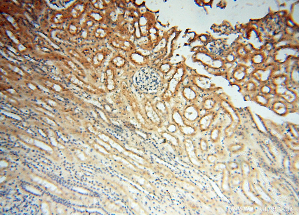 Immunohistochemistry (IHC) staining of human kidney tissue using CHST14 Polyclonal antibody (17749-1-AP)