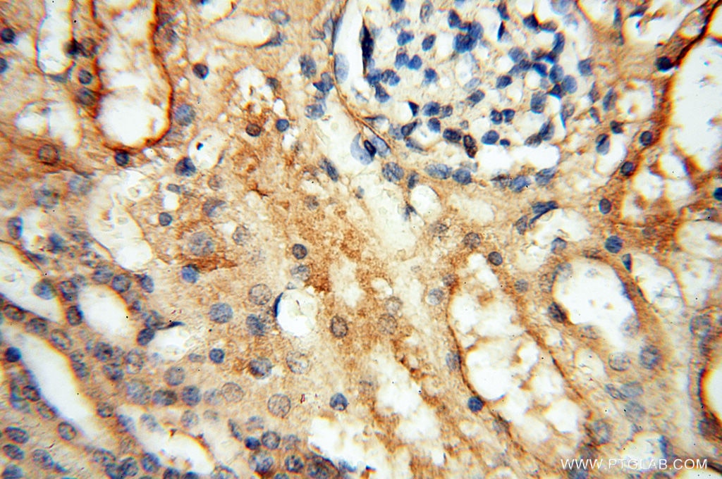 Immunohistochemistry (IHC) staining of human kidney tissue using CHST14 Polyclonal antibody (17749-1-AP)