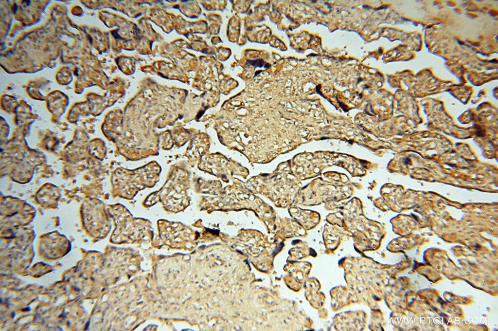 Immunohistochemistry (IHC) staining of human placenta tissue using CHST14 Polyclonal antibody (17749-1-AP)