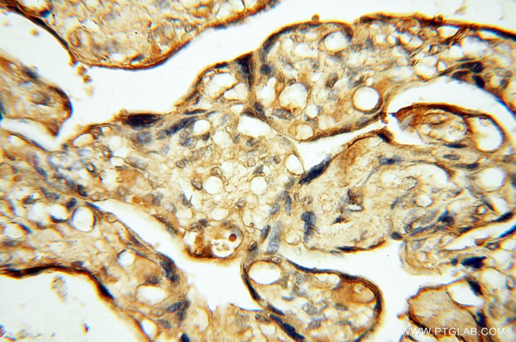 Immunohistochemistry (IHC) staining of human placenta tissue using CHST14 Polyclonal antibody (17749-1-AP)