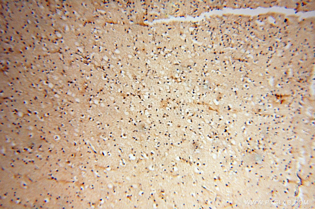 Immunohistochemistry (IHC) staining of human brain tissue using CHST14 Polyclonal antibody (17749-1-AP)