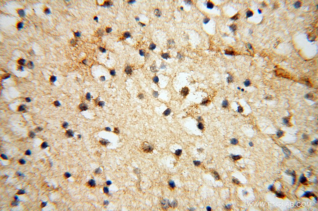 Immunohistochemistry (IHC) staining of human brain tissue using CHST14 Polyclonal antibody (17749-1-AP)