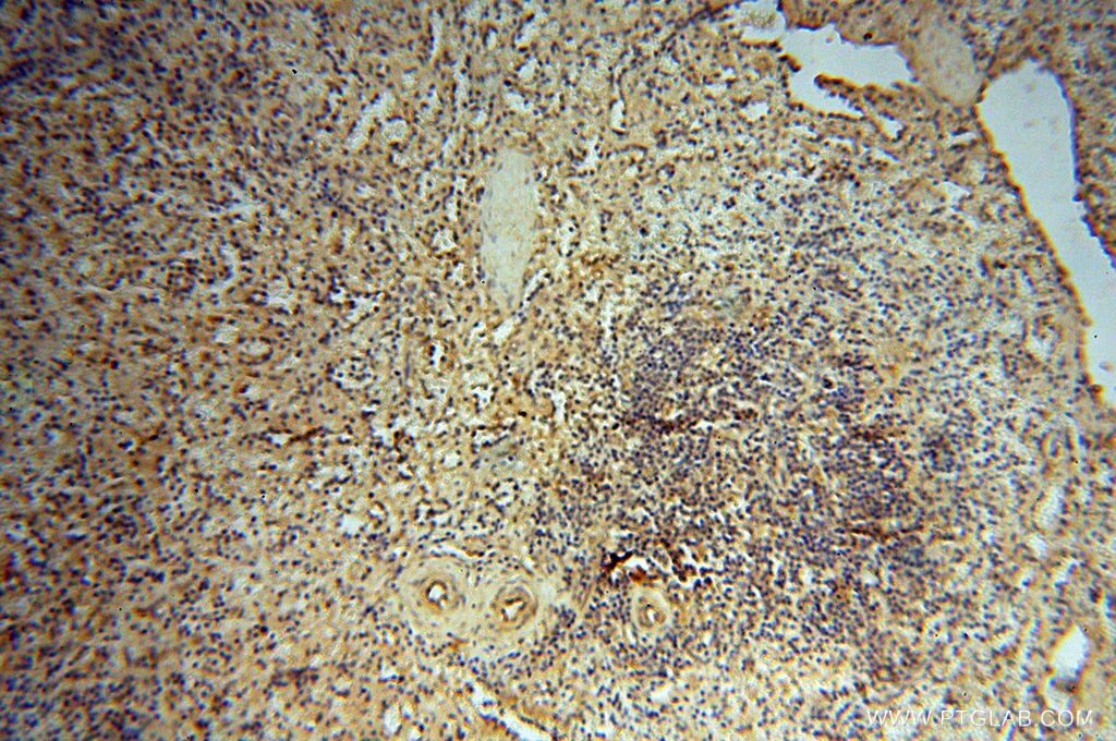 Immunohistochemistry (IHC) staining of human spleen tissue using CHST14 Polyclonal antibody (17749-1-AP)