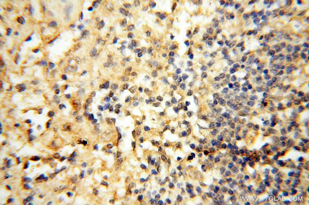 Immunohistochemistry (IHC) staining of human spleen tissue using CHST14 Polyclonal antibody (17749-1-AP)