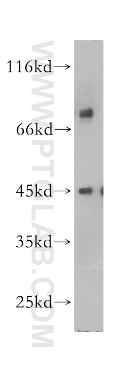 Western Blot (WB) analysis of HepG2 cells using CHST14 Polyclonal antibody (17749-1-AP)