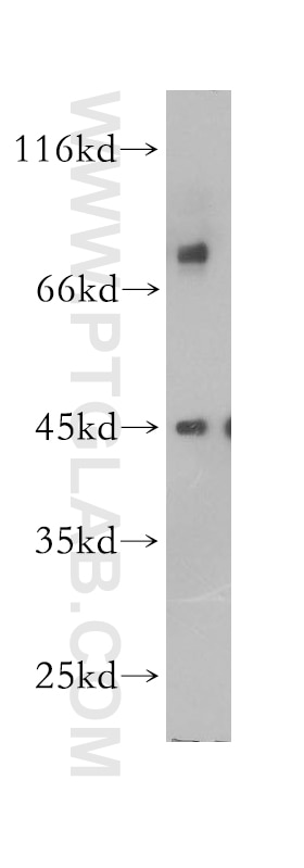 WB analysis of HepG2 using 17749-1-AP