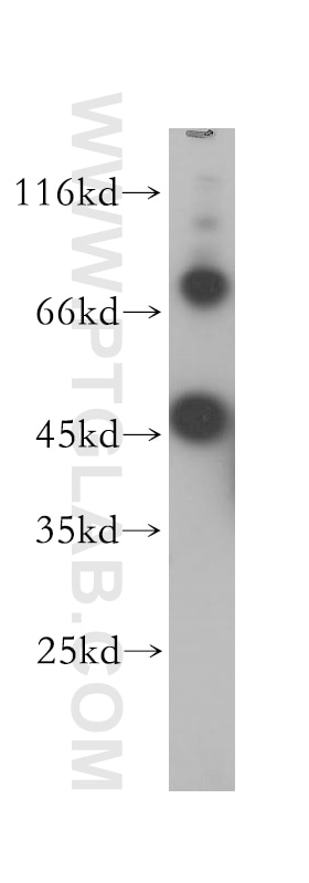 Western Blot (WB) analysis of HEK-293 cells using CHST14 Polyclonal antibody (17749-1-AP)