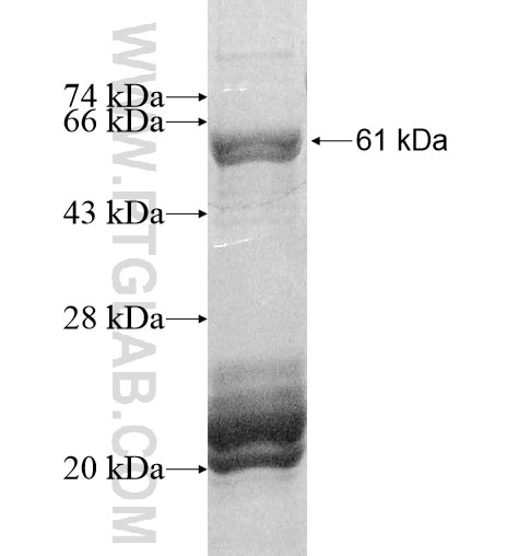 CHST14 fusion protein Ag12014 SDS-PAGE
